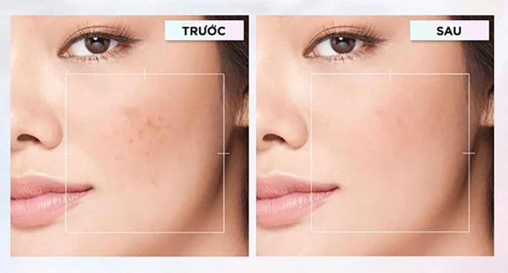 mỹ phẩm Serien beauty